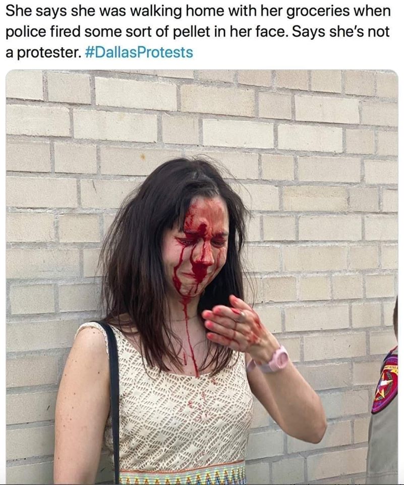 Here's an analysis of the image and caption, broken down into sections as requested. I'll indicate when a particular theoretical framework doesn't readily apply. **Visual Description** The image depicts a woman with b...